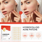 Hydrocolloid Acne Pimple Patches – Invisible Spot Care Set